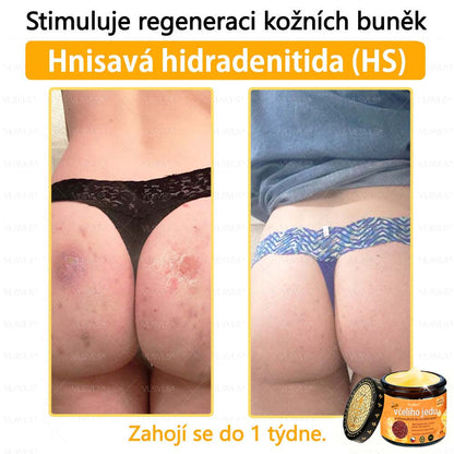 ✅Foulme® Obnovující krém se včelím jedem🐝