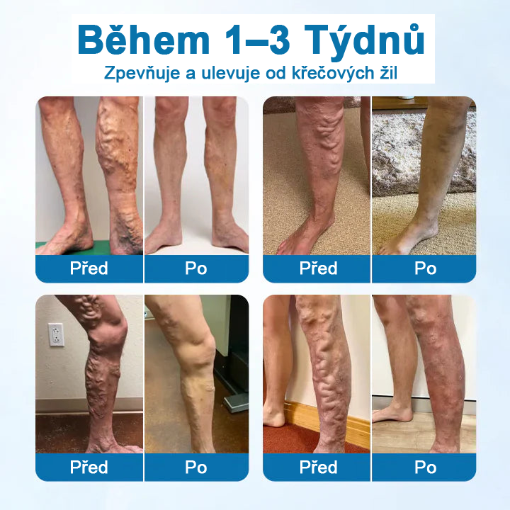 Timnilk® VeinGuard bylinný sprej – ✅ Klinicky prokázáno, že odstraní křečové žíly za pouhých 7 dní!