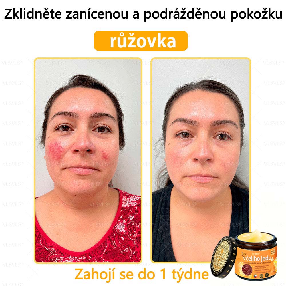 ✅Foulme® Obnovující krém se včelím jedem🐝