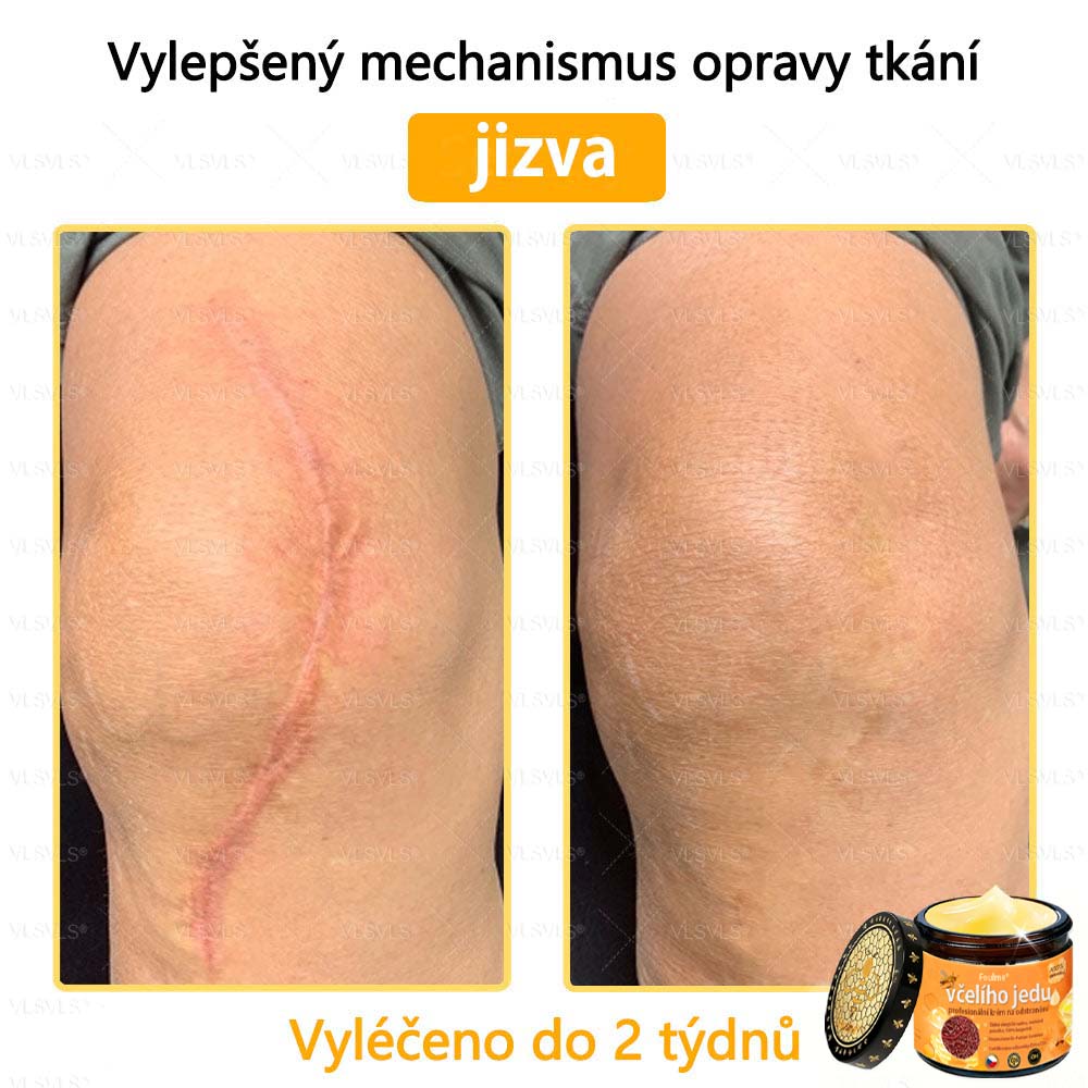 ✅Foulme® Obnovující krém se včelím jedem🐝