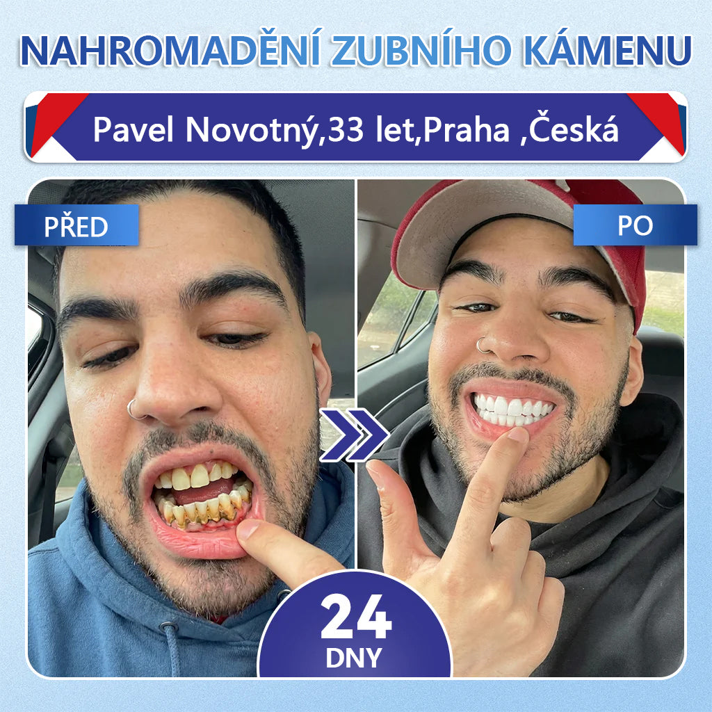 Glimmerly® Tideglusib – rychle se rozpouštějící ústní proužky pro regeneraci zubů a dásní