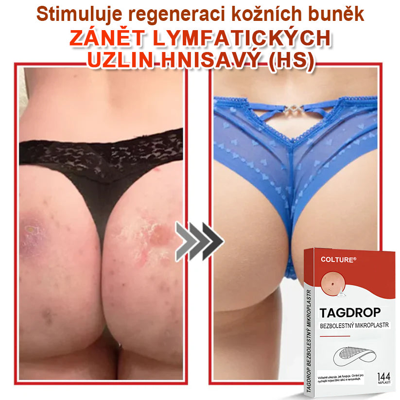 COLTURE® Mikrovpichová botanická náplast na odstranění kožních výrůstků