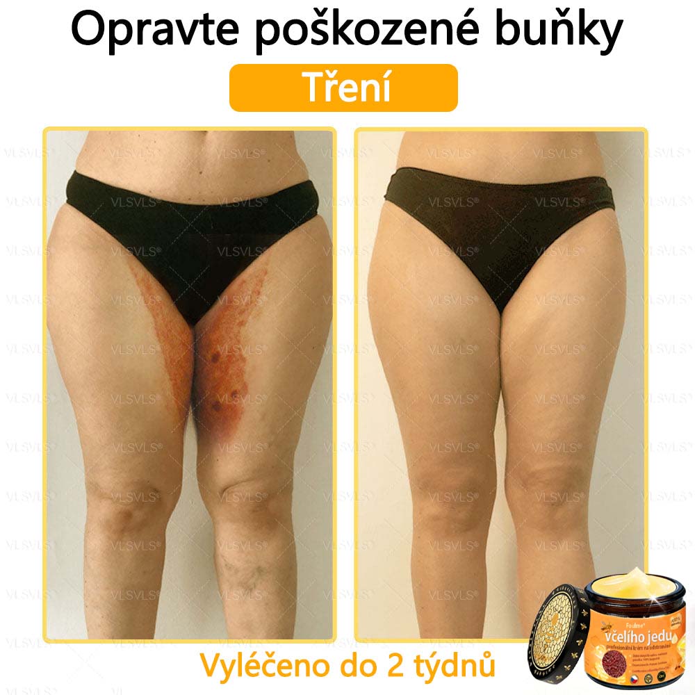 ✅Foulme® Obnovující krém se včelím jedem🐝