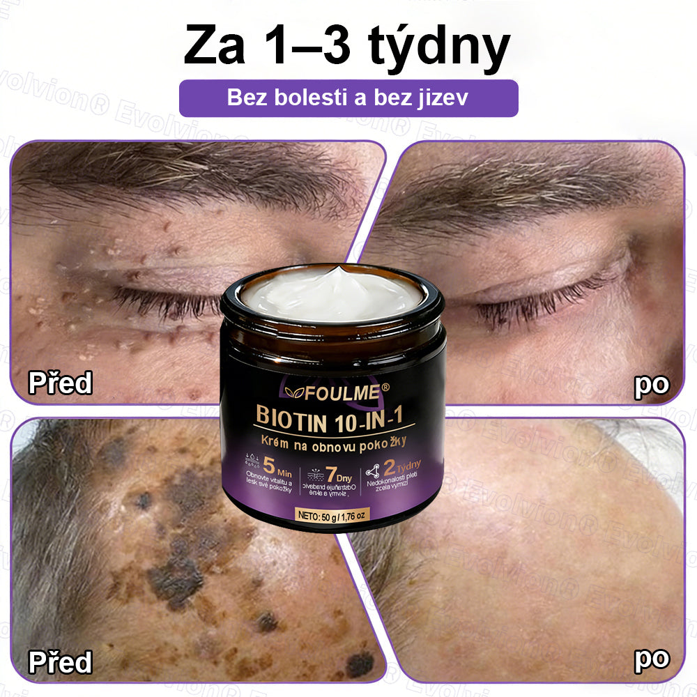 ✅Vyrobeno a dodáno z České republiky ✨⚡ FOULME® Biotin 10-v-1 krém na obnovu pokožky