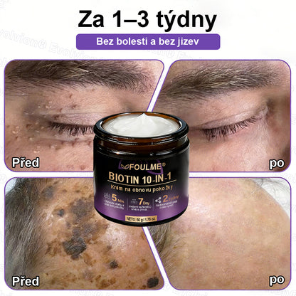 ✅Vyrobeno a dodáno z České republiky ✨⚡ FOULME® Biotin 10-v-1 krém na obnovu pokožky