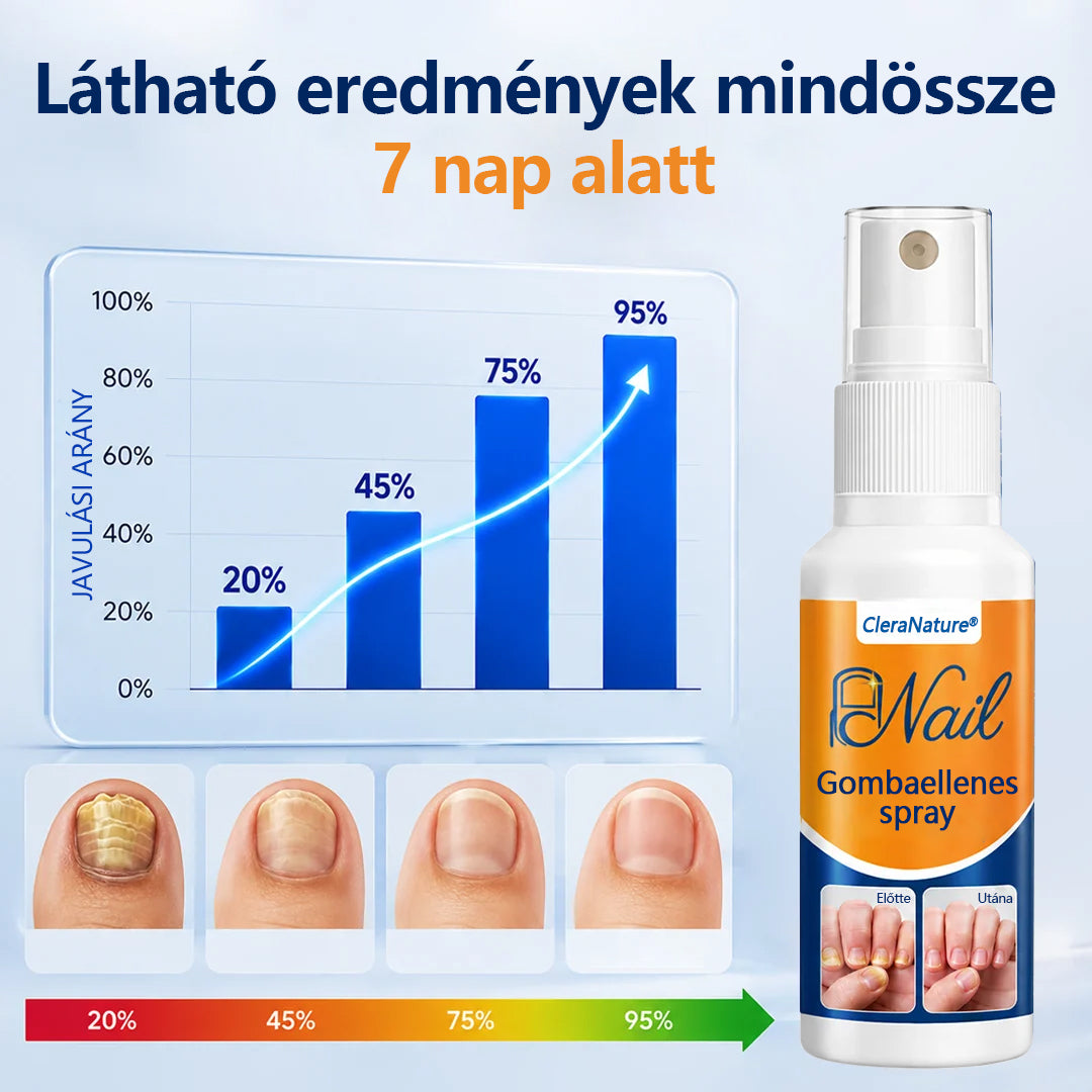 CleraNaure® körömgomba‑könnyítő spray