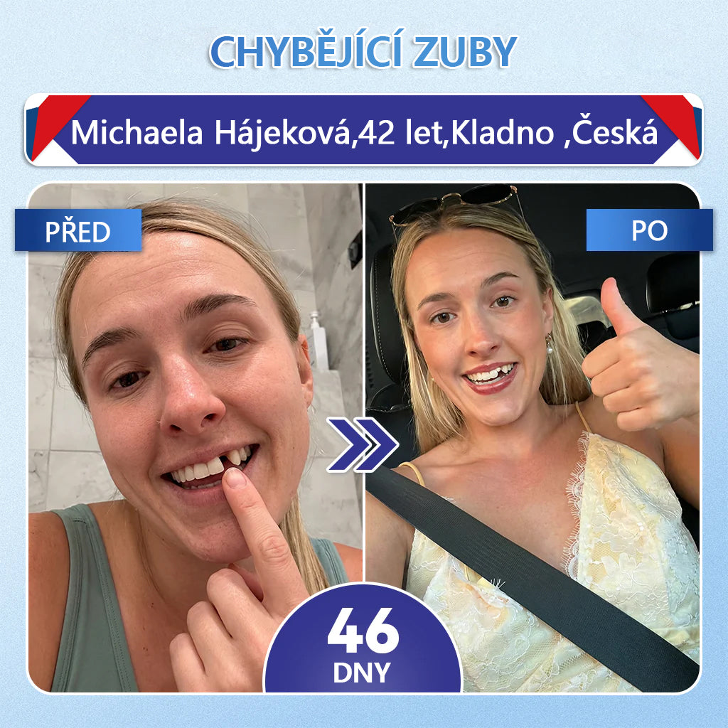 Glimmerly® Tideglusib – rychle se rozpouštějící ústní proužky pro regeneraci zubů a dásní