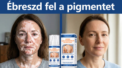 CleraNaure® Piperine Repigment Aktivátor Spray, amely aktiválja a lappangó pigmentsejteket, és visszaállítja a természetes bőrszínt.