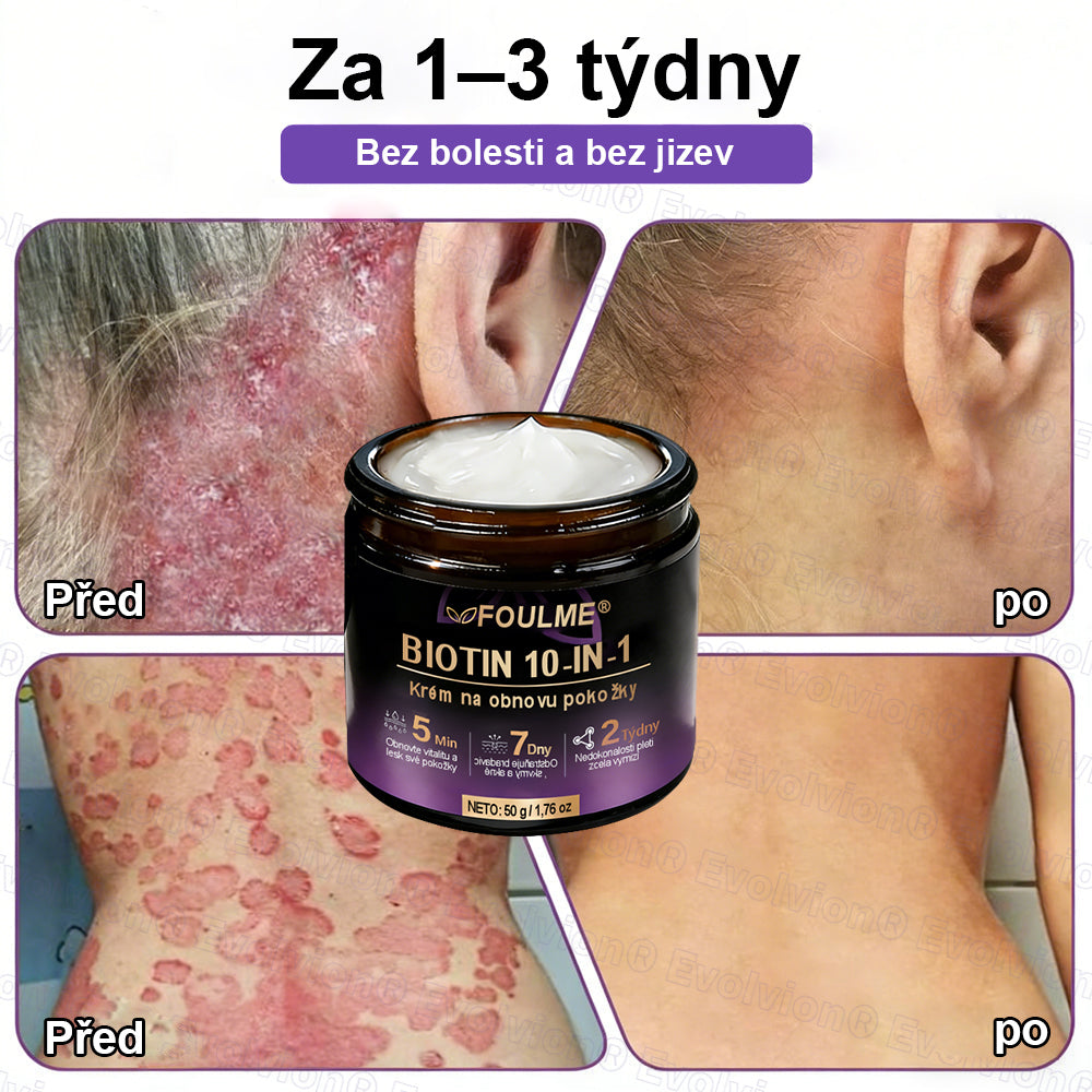 ✅Vyrobeno a dodáno z České republiky ✨⚡ FOULME® Biotin 10-v-1 krém na obnovu pokožky