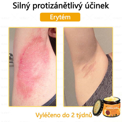 ✅Foulme® Obnovující krém se včelím jedem🐝
