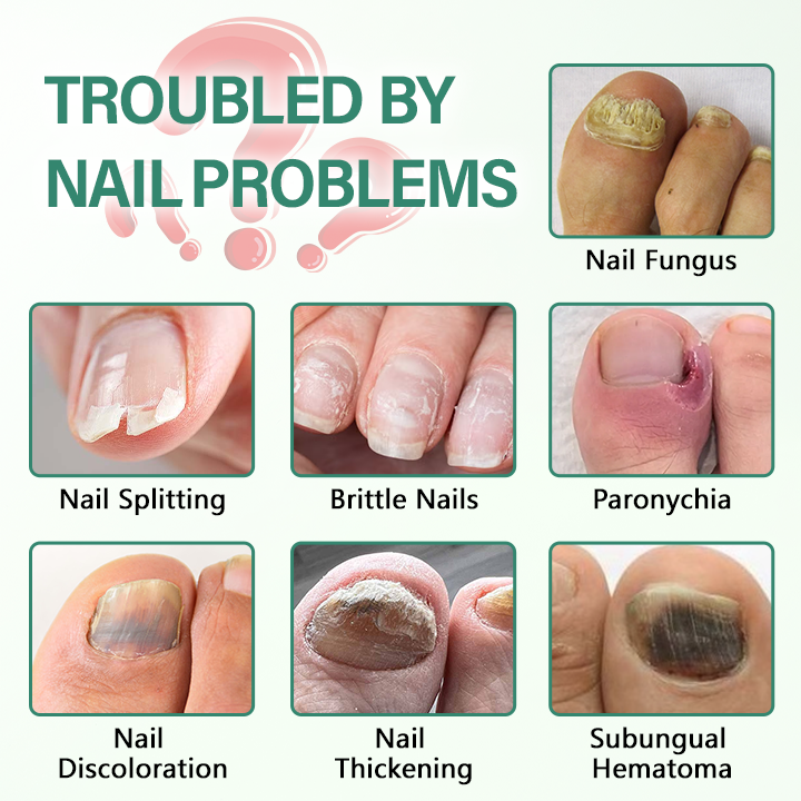 CleraNaure® Nail Detox – penetrační sérové pero na nehty