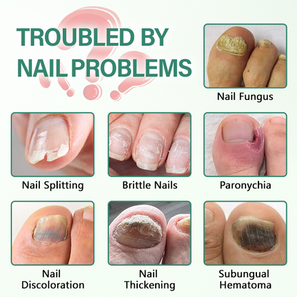 CleraNaure® Nail Detox – penetrační sérové pero na nehty