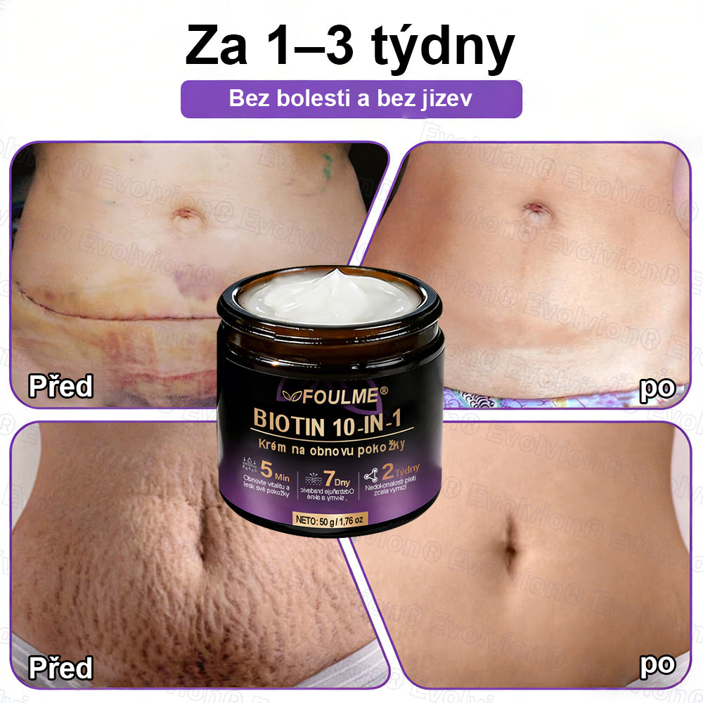 ✅Vyrobeno a dodáno z České republiky ✨⚡ FOULME® Biotin 10-v-1 krém na obnovu pokožky