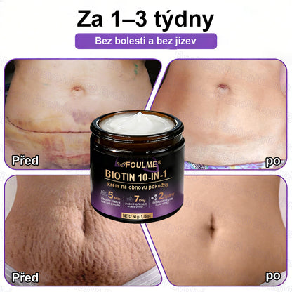 ✅Vyrobeno a dodáno z České republiky ✨⚡ FOULME® Biotin 10-v-1 krém na obnovu pokožky