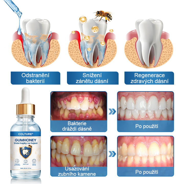 COLTURE® GumHoney kapky na regeneraci ústní dutiny