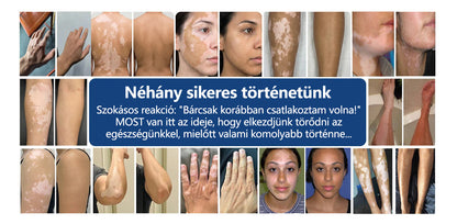 CleraNaure® Piperine Repigment Aktivátor Spray, amely aktiválja a lappangó pigmentsejteket, és visszaállítja a természetes bőrszínt.