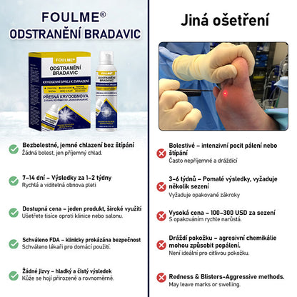 Foulme® WartErase Kryogenní sprej