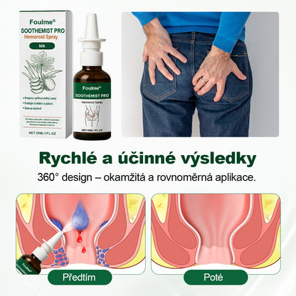 Foulme® SootheMist PRO sprej na hemoroidy