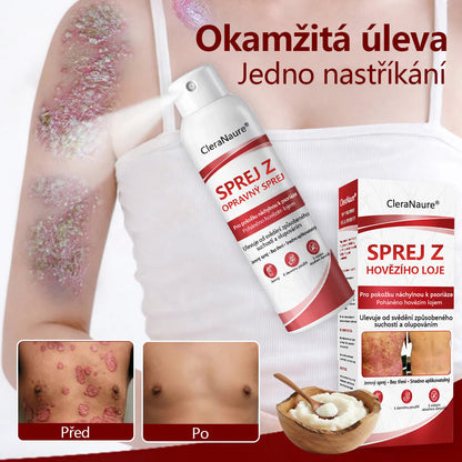 CleraNature® Sprej s Hovězím Tvarohem pro Svědící, Olupující se Pokožku Při Psoriáze