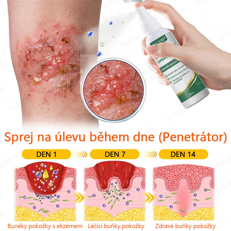 COLTURE® Systém pro denní a noční péči o ekzémy – dvojbalení bez steroidů pro úlevu od intenzivního svědění, zarudnutí a porušené pokožky (akční nabídka)