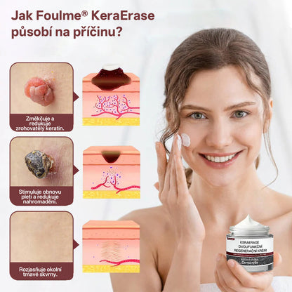 Foulme® KeraErase Dvoufázový Regenerační Krém