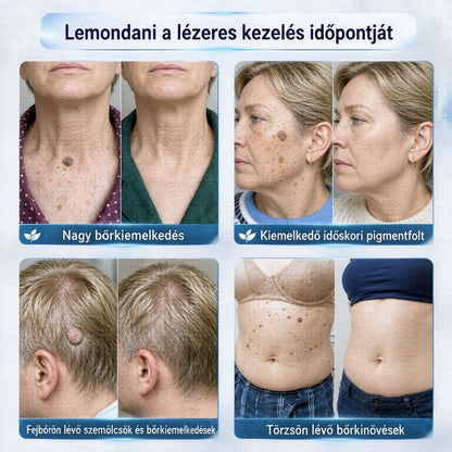 CleraNaure® Bőr Egyenetlenség Finomító Krém｜Segít a zavaró bőrkiemelkedések, anyajegyek és pigmentfoltok kezelésében, kíméletes otthoni bőrápoló krém🌿