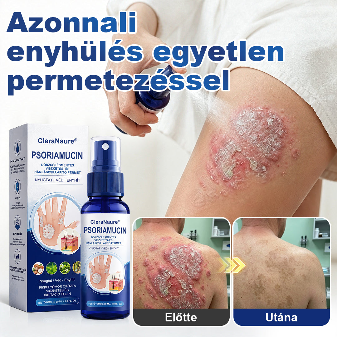 CleraNaure® PsoriaMucin Dörzsölésmentes Viszketés- és Pikkelyenyhítő Permet🥇