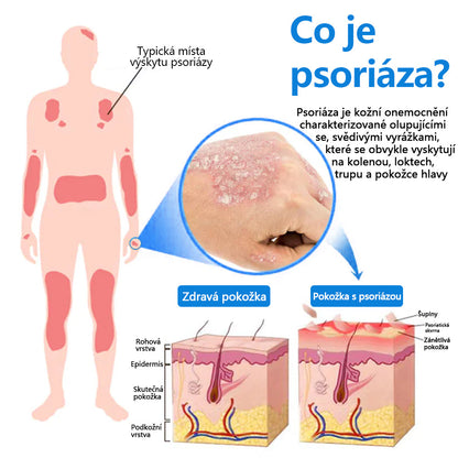 ✅COLTURE® Magnesium bylinný sprej ⚕️ Certifikace MHRA – úleva při psoriáze, ekzému, intimních bakteriálních infekcích, akné a tmavých skvrnách