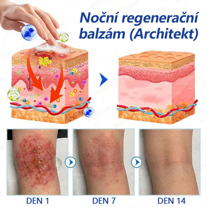 COLTURE® Systém pro denní a noční péči o ekzémy – dvojbalení bez steroidů pro úlevu od intenzivního svědění, zarudnutí a porušené pokožky (akční nabídka)