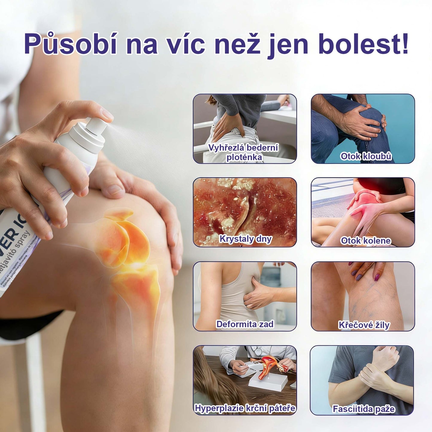 Timnlik® sprej na klouby se stříbrnými ionty🔆🔆