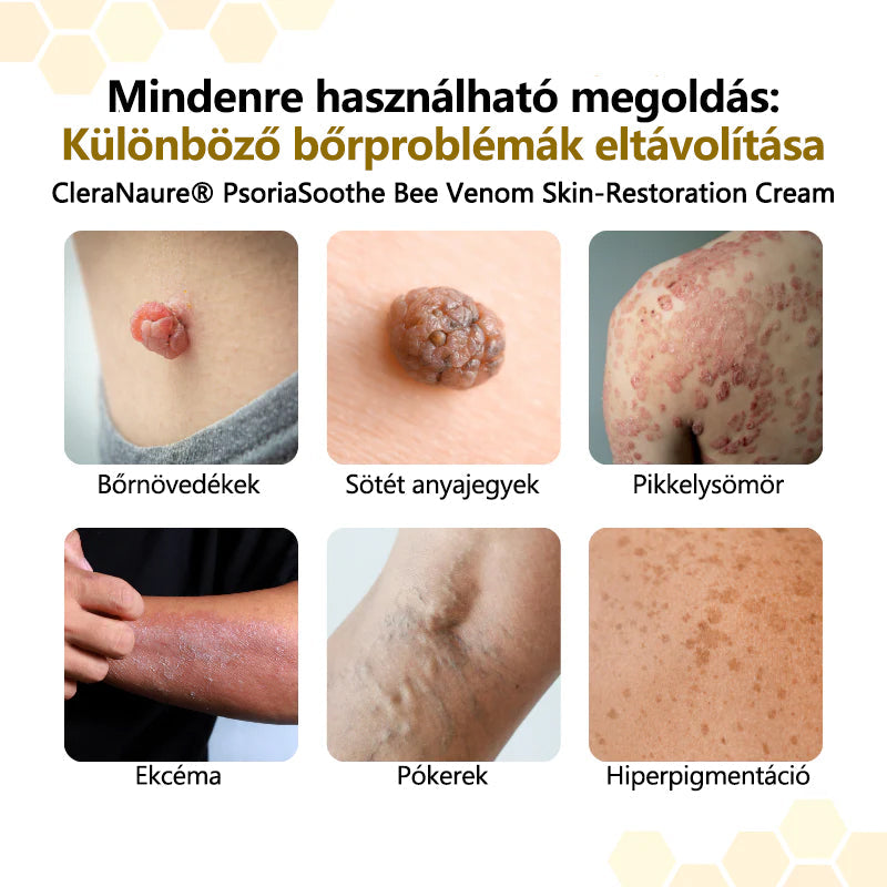 CleraNaure® PsoriaSoothe Méhméreg Bőrregeneráló Krém