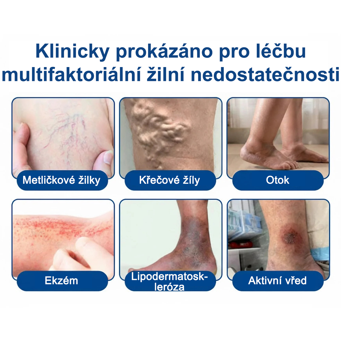 FLORISMA® Klinická mikrojehličková náplast s diosminem a hesperidinem🌿 – zaměřená na křečové a metličkové žilky, pomáhá zmírnit pocit těžkých a unavených nohou