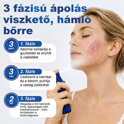 CleraNaure® PsoriaMucin Dörzsölésmentes Viszketés- és Pikkelyenyhítő Permet🥇