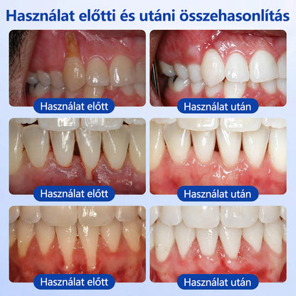 CleraNaure® GumRevive fogágy-szövetregeneráló gél
