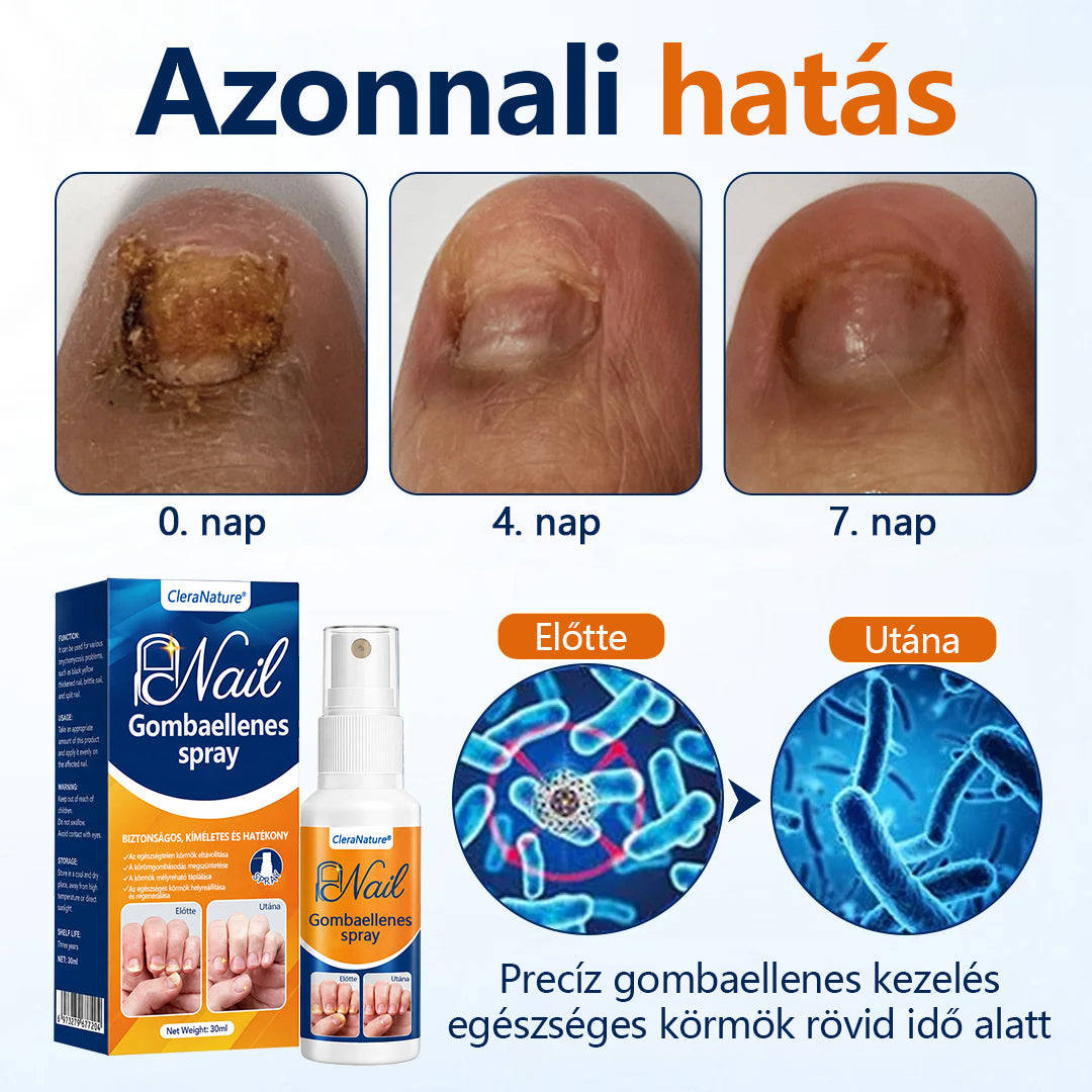 CleraNaure® körömgomba‑könnyítő spray