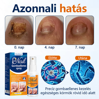 CleraNaure® körömgomba‑könnyítő spray