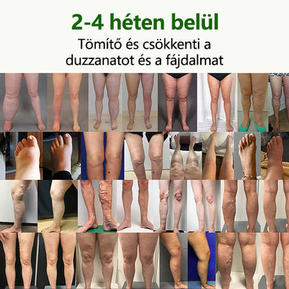 CleraNaure® FluidEase Professzionális krém—Mondj búcsút a lábdagadásnak és -fájdalomnak