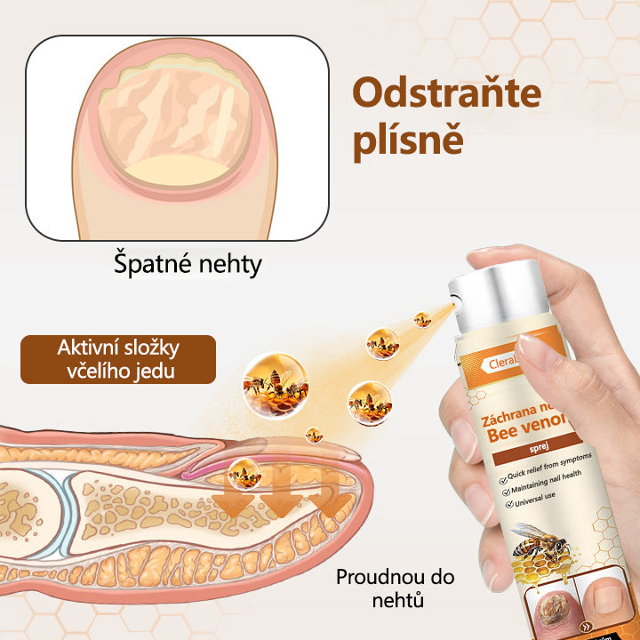 ✅✅【Oficiální vlajkový obchod】CleraLuxe® NailRescue Včelí jed ve spreji