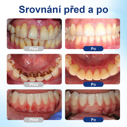 COLTURE® GumHoney kapky na regeneraci ústní dutiny