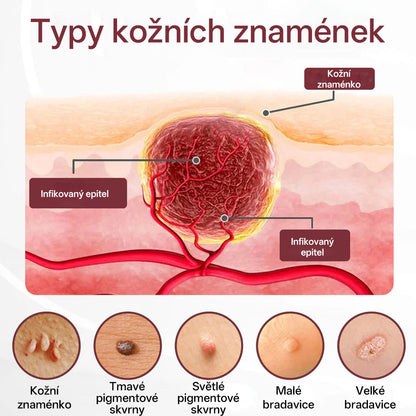 Foulme® KeraErase Dvoufázový Regenerační Krém