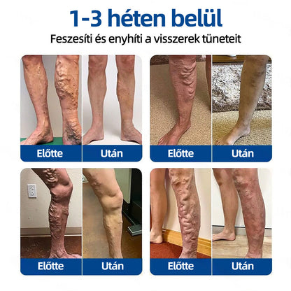 𝐇𝐞𝐚𝐥𝐫𝐢𝐳𝐞®VeinTarget mikrotűs tapasz☑️Azonnali enyhülés hosszú távú eredmények