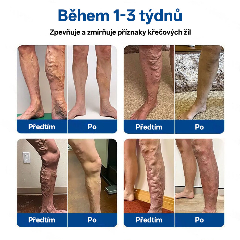🇨🇿 💧✅GFOUK® VeinTarget Microneedle Patch |⚡ Okamžitá úleva, dlouhodobé výsledky🌱🛌