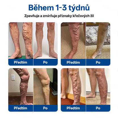 🇨🇿 💧✅GFOUK® VeinTarget Microneedle Patch |⚡ Okamžitá úleva, dlouhodobé výsledky🌱🛌