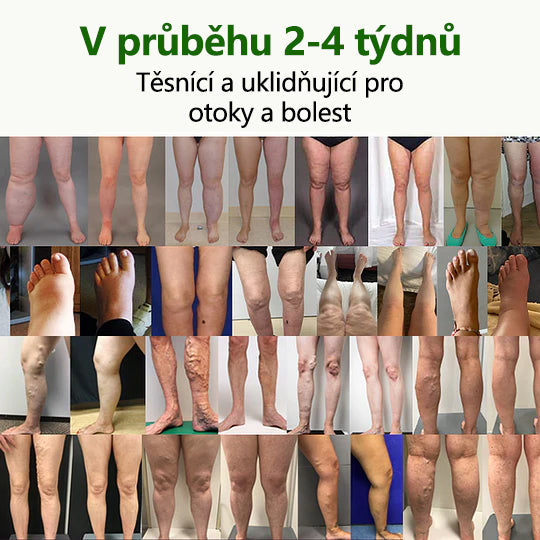 Řekněte sbohem oteklým, bolestivým nohám – CleraNaure® FluidEase Profesionální krém pro prokrvení nohou přináší skutečnou úlevu!