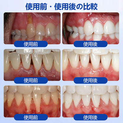 CleraNaure® GumRevive fogágy-szövetregeneráló gél
