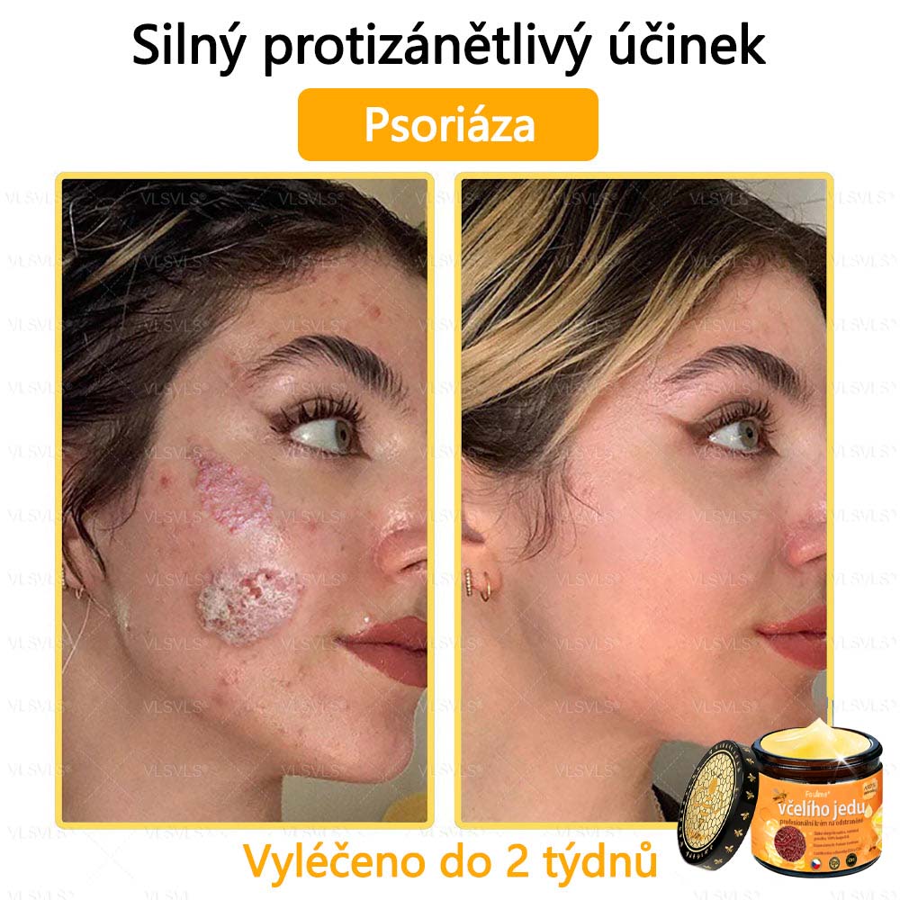 ✅Foulme® Obnovující krém se včelím jedem🐝
