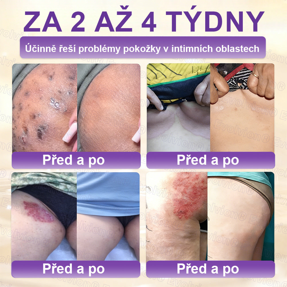 ✅Vyrobeno a dodáno z České republiky ✨⚡ FOULME® Biotin 10-v-1 krém na obnovu pokožky