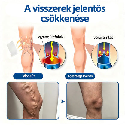 𝐇𝐞𝐚𝐥𝐫𝐢𝐳𝐞®VeinTarget mikrotűs tapasz☑️Azonnali enyhülés hosszú távú eredmények