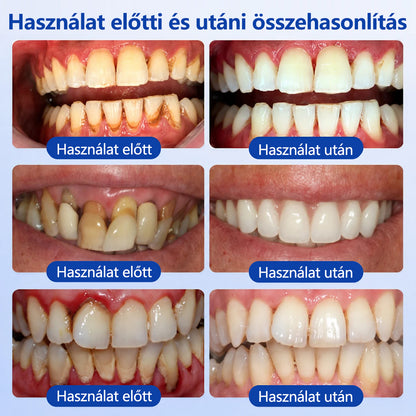 CleraNaure® GumRevive fogágy-szövetregeneráló gél