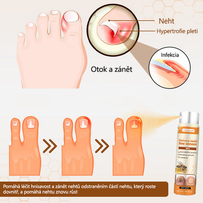 ✅✅【Oficiální vlajkový obchod】CleraLuxe® NailRescue Včelí jed ve spreji